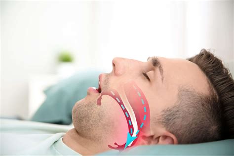 Did You Know Your Dentist Can Help With Sleep Apnea