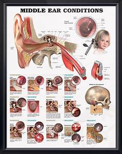 Middle Ear Conditions Chart 20x26 Middle Ear Ear Anatomy Medical