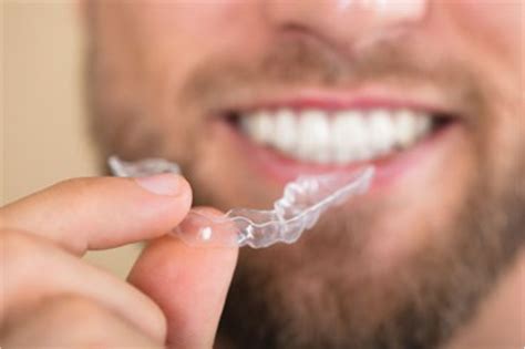 We have everything you need to know about the best invisible aligners for straighter teeth. Teeth Straightening Without Braces with SureSmile Aligners ...