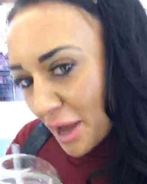 josie cunningham gets £3k crooked smile on taxpayers money as she gets new teeth from nhs