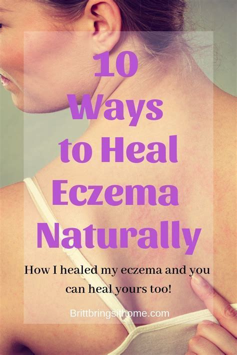 How I Healed My Eczema And 10 Tips For You To Heal Your Eczema