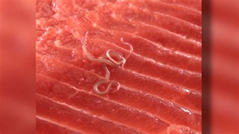 Woman Says She Found Worms In Salmon Bought At Southern California
