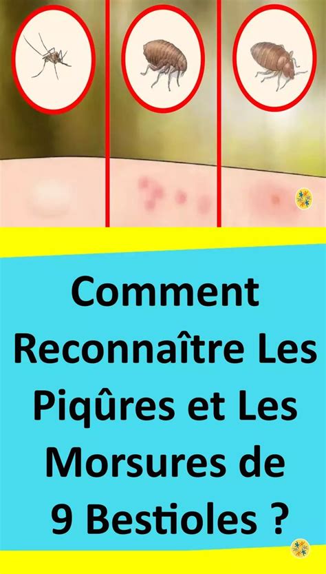 Des Piqûres Et Des Morsures De 9 Bestioles à Connaitre Piqure Piqure