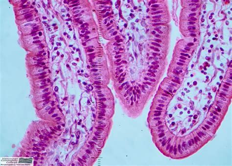 Simple Columnar Epithelium Description Single Layer Of Elongated