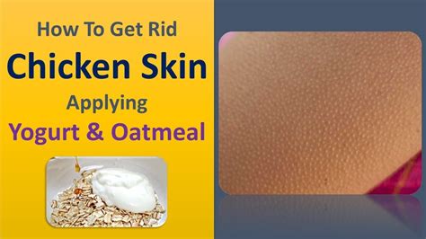 How To Get Rid Chicken Skin Applying Yogurt And Oatmeal Youtube