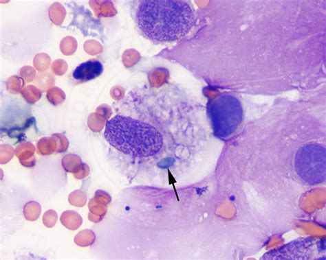 Infectious Agents Cytology Eclinpath