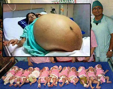 According to her husband tebogo tsotetsi, the babies were delivered by a caesarean section surgery at a hospital in pretoria. Woman Gives Birth To 11 Babies WITHOUT C-Section Delivery