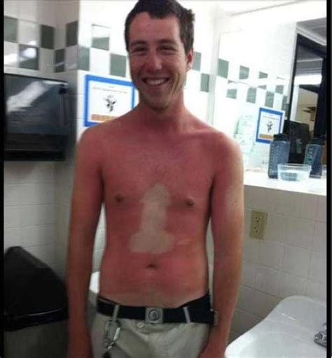 22 People Living With The Worlds Most Awkward Sun Tan Line Fails Ever Daily Digest