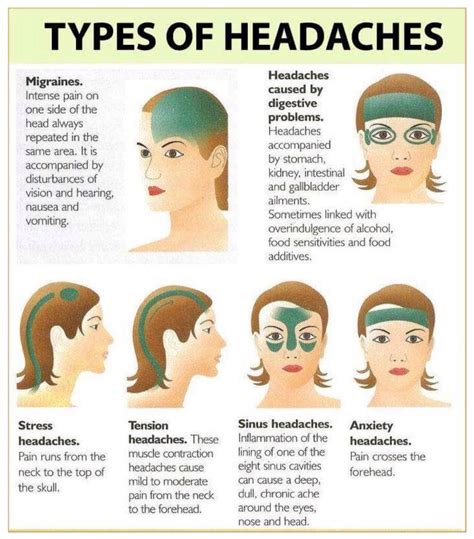 This Is Good To Know Headache Types Migraines Remedies Tension Headache