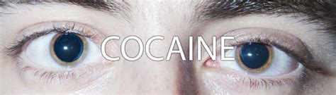 [photos] How To Identify A Drug User By Looking At Their Eyes Stethnews