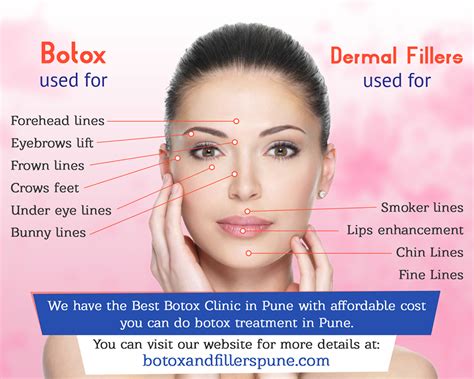Botox Injections For Your Wrinkle Free Skin Botox Clinic Botox