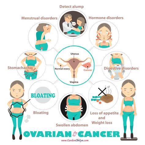 Ovarian Cancer The Importance Of Recognizing The Symptoms Garden Obgyn Obstetrics
