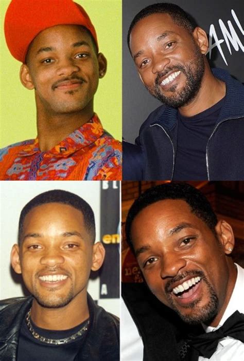 Will Smiths Plastic Surgery Is Making Rounds On The Internet