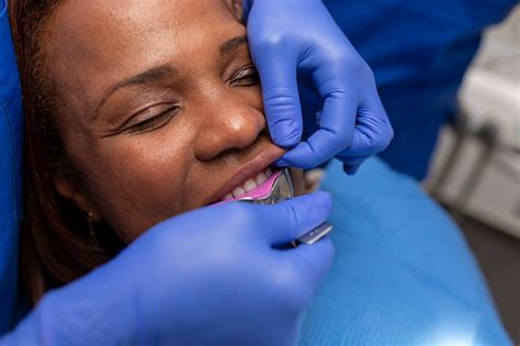 Close Up View Of A Black Woman Patient Being Put On An Impression Tray