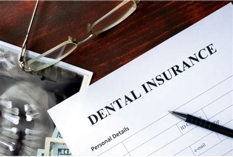 How can i get a root canal cheaper? Will Dental Insurance Cover My Root Canal? - Sachem Dental ...