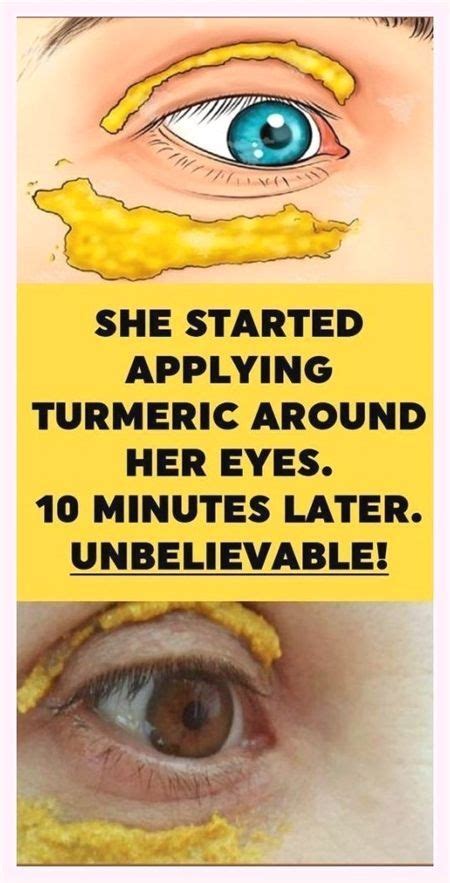 SHE STARTED APPLYING TURMERIC AROUND HER EYES 10 MINUTES LATER