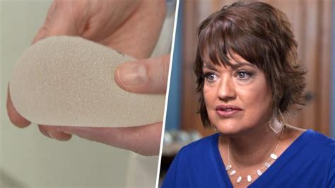 Allergan Breast Implants Linked To Cancer Recalled After Fda Request
