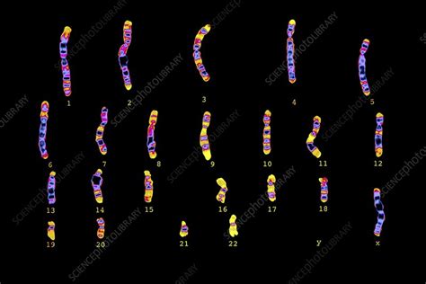 Human Sex Cell Karyotype Stock Image C Science Photo Library