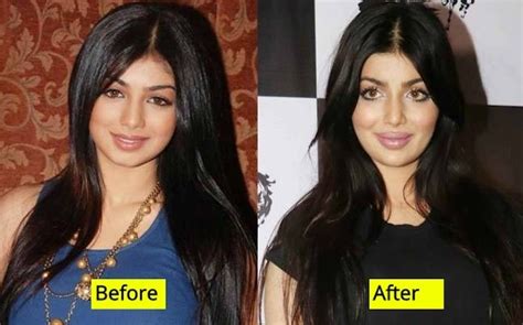 Then And Now Looks Of 10 Bollywood Actresses Who Have Undergone Plastic