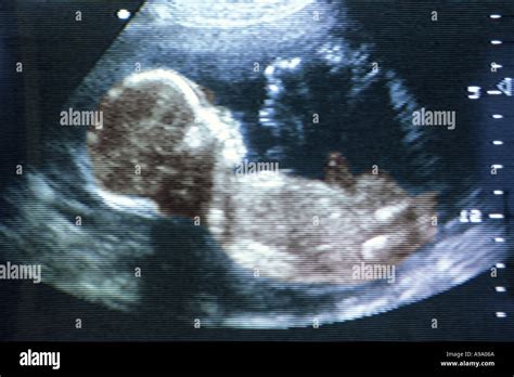 5 Month Pregnancy Baby Ultrasound Babypregnancy