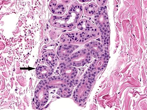 Pathology Outlines Histology