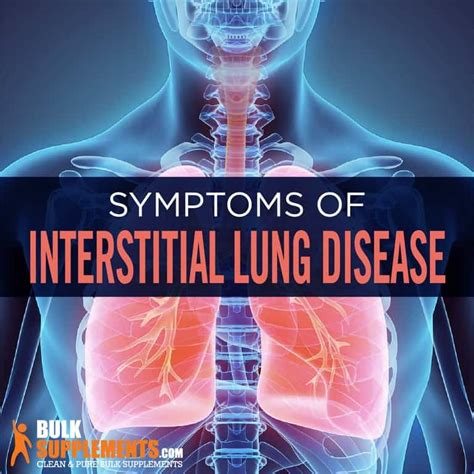 Interstitial Lung Disease Symptoms Causes And Treatment