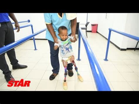 Baby Born Without Limbs Takes First Steps YouTube