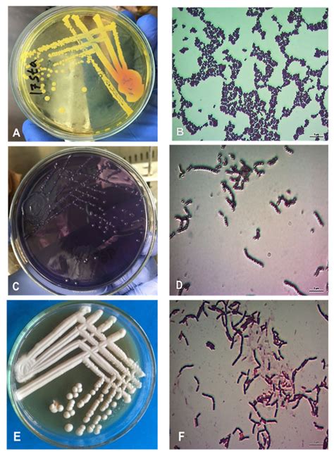 Morphology Of S Aureus Streptococcus And Lactobacillus A Cultural