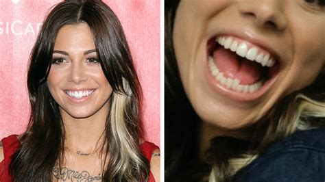 Celebrities With Crooked Front Teeth