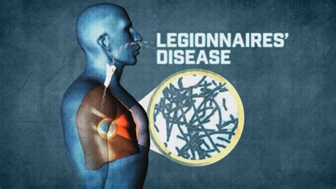Two Guests At The Rio Hotel In Las Vegas Contracted Legionnaires Disease
