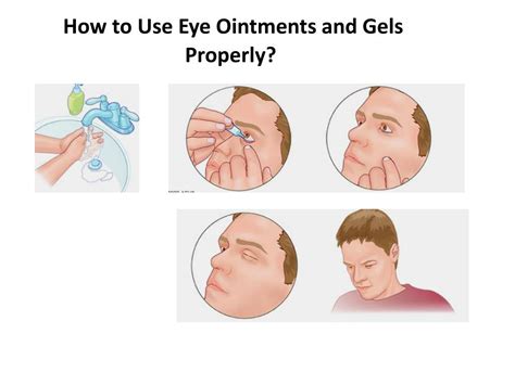 Ppt Ophthalmic Preparations Powerpoint Presentation Free Download Id595499