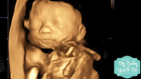 24 Weeks Pregnant 4d Ultrasound Kizacup