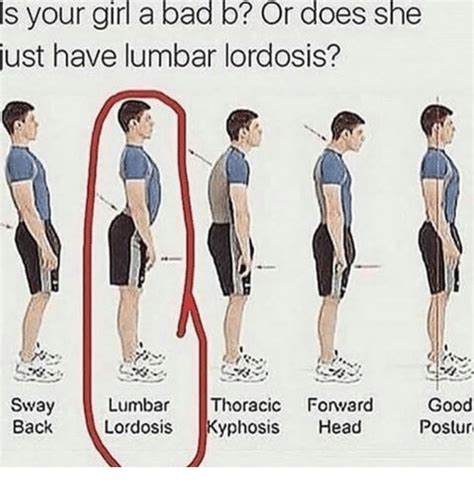 Sway Lumbar Thoracic Forward Gool Back Lordosis Kyphosis