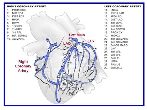 Alderman El Stadius Ml The Angiographic Definitions Of The Bypass