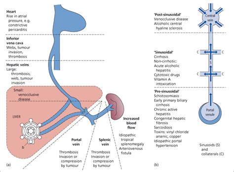 9 The Hepatic Artery Portal Venous System And Portal Hypertension The