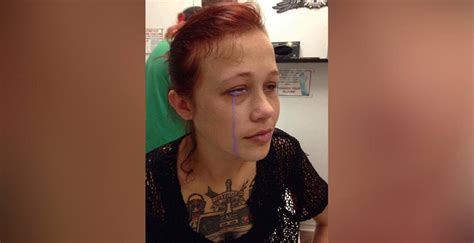 Canadian Woman Could Go Blind After Getting Eyeball Tattooed Photos