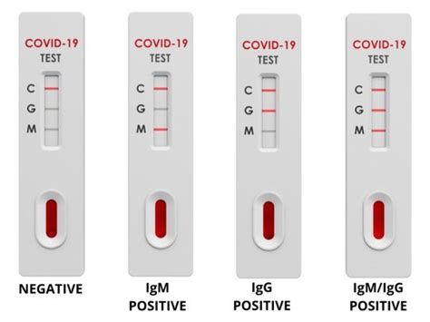 Types of testing • how can i get tested? Rapid COVID-19 tests: What negative or positive results ...