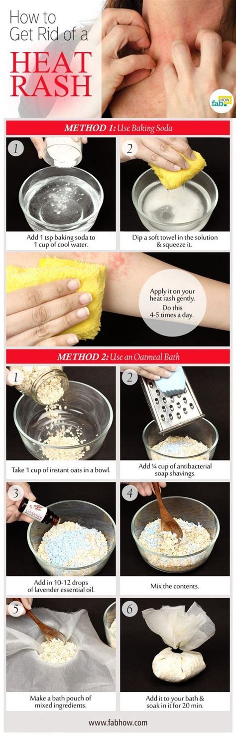 Best Home Remedy To Get Rid Of Heat Rash While Summer Is A