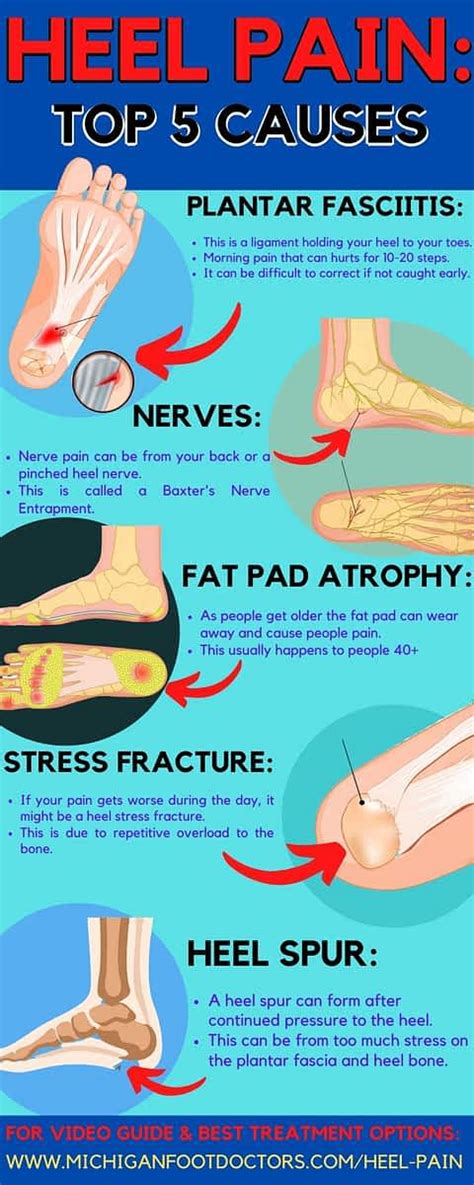 Heel Pain After Rest Causes Symptoms Best Treatment