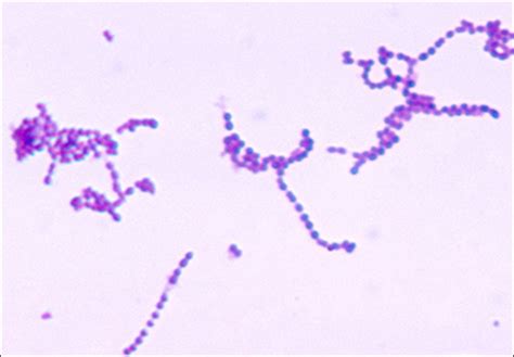Streptococcus Pyogenes Under Microscope Sexiz Pix