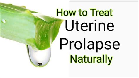 How To Treat Uterine Prolapse Pelvic Prolapse Regain Womanhood Hot