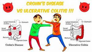 Crohn 39 S Vs Ulcerative Colitis The Battle Of The Bowels Youtube