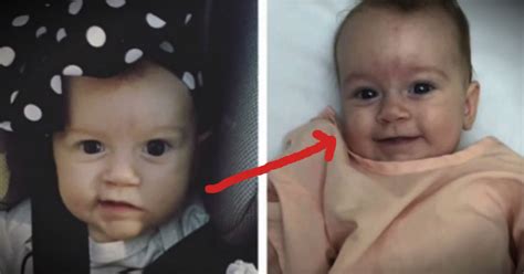 Their Babys Brain Tumor Baffled Doctors After God Sent A Miracle