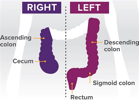 Tumor Location Affects Colon Cancer Survival