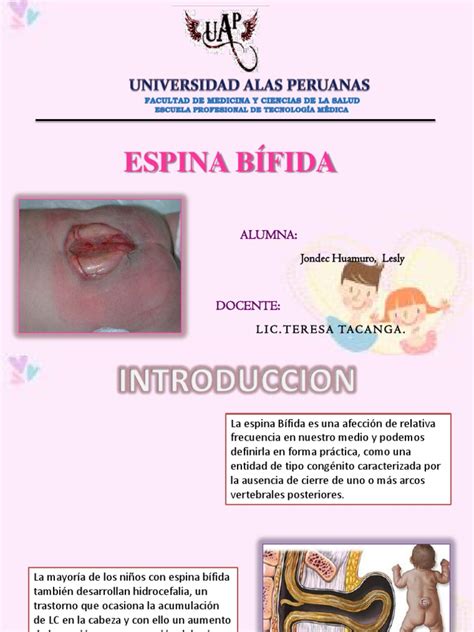 Espina Bifida Especialidades Medicas Medicina Clinica