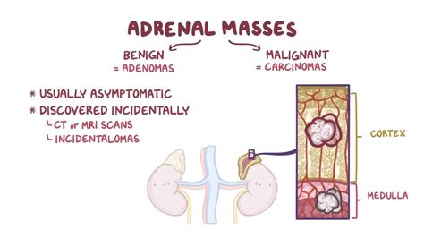 And Tumors The Of Adrenal Glands