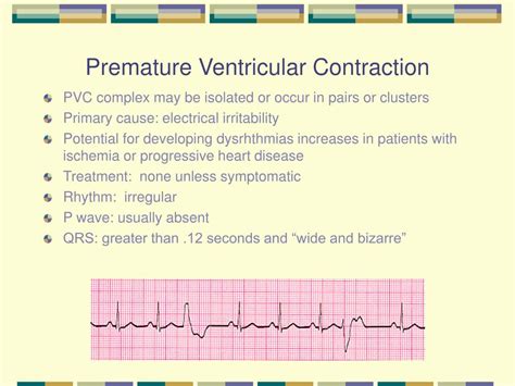 Premature Ventricular Contractions Pvcs Example Images And Photos My