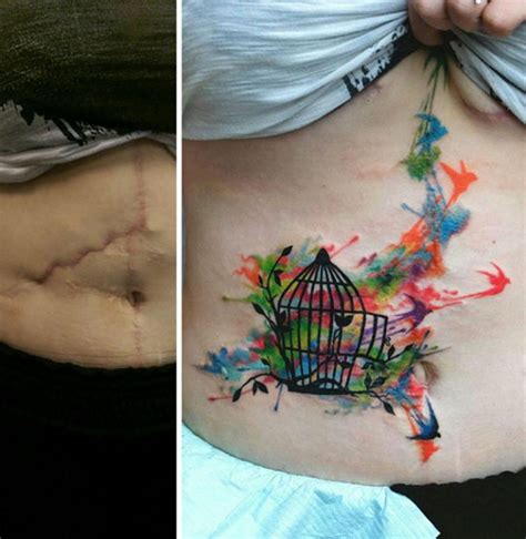 20 Amazing Tattoos That Turn Scars Into Works Of Art