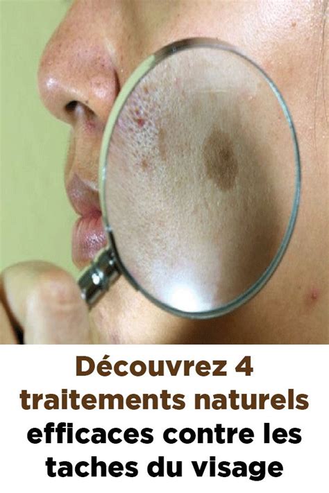 Découvrez 4 Traitements Naturels Efficaces Contre Les Taches Du Visage