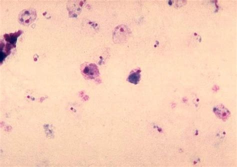 Kostenlose Bild Plasmodium Vivax Gametocyte Reif Trophozoite Parasiten